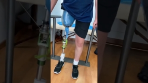 Cómo funciona una prótesis de pierna